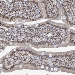 MRPS12 Antibody, Novus Biologicals:Antibodies:Primary Antibodies
